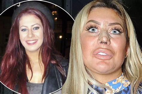 chloe ferry lipo|chloe ferry before and after surgery.